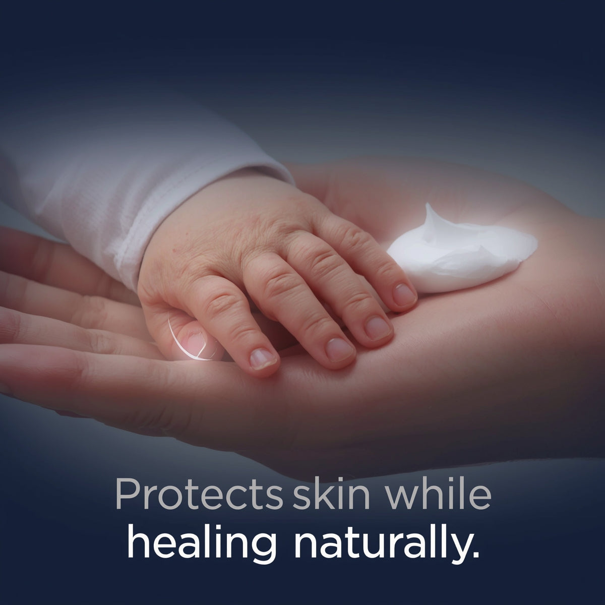 Aquaphor Baby Healing Cream