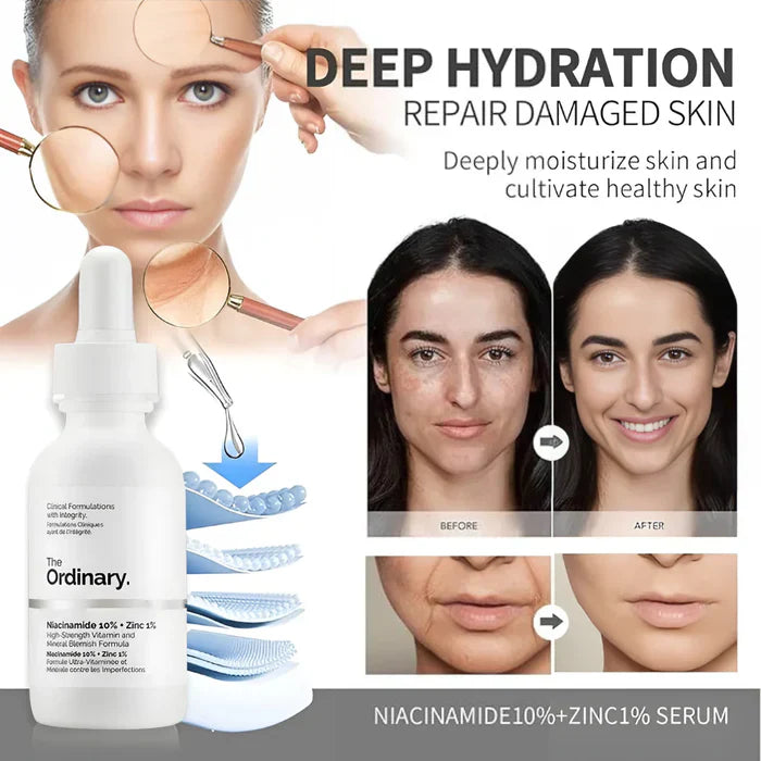 The Ordinary Niacinamide 10% + Zinc 1% 30ml