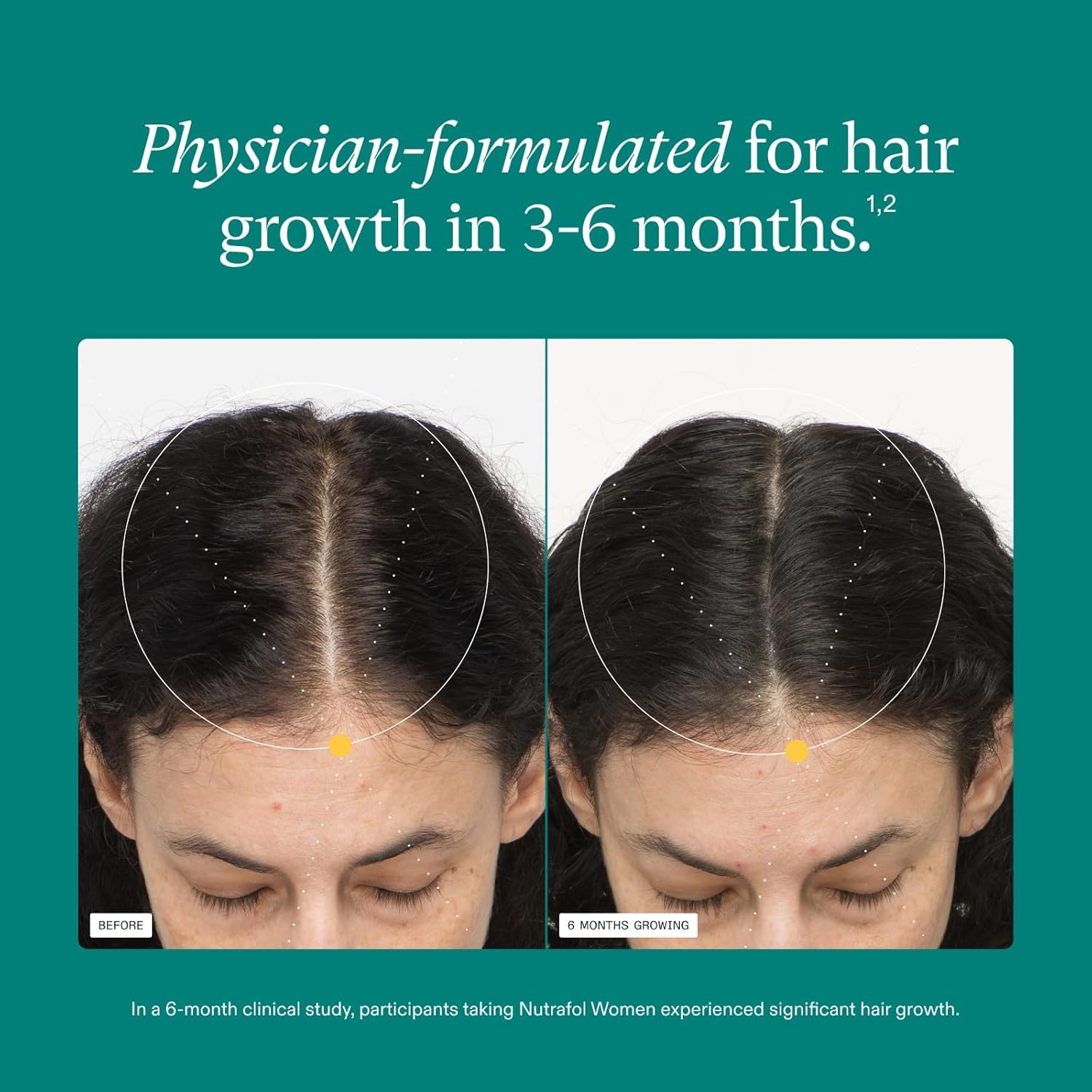 Nutrafol Women's Hair Growth Supplement