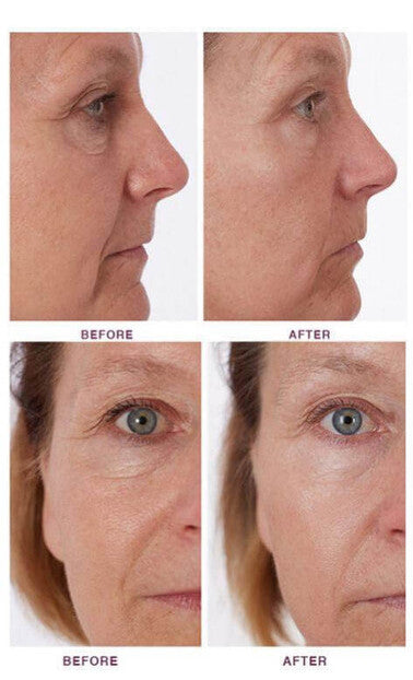 The Ordinary Niacinamide 10% + Zinc 1% 30ml